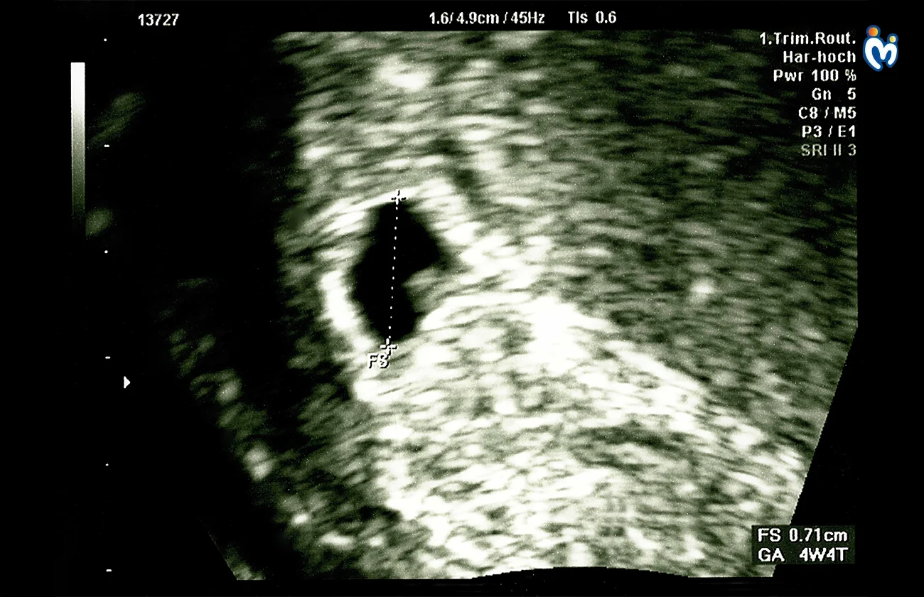 Baby How Much Has Baby Developed 1732515826426